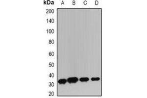 Western blot analysis of TIM3 expression in HepG2 (A), BT474 (B), mouse lung (C), mouse thymus (D) whole cell lysates.