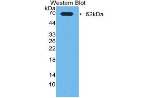 Western Blotting (WB) image for anti-Phosphoinositide-3-Kinase, Class 2, alpha Polypeptide (PIK3C2A) (AA 349-611) antibody (ABIN1863045) (PIK3C2A anticorps  (AA 349-611))