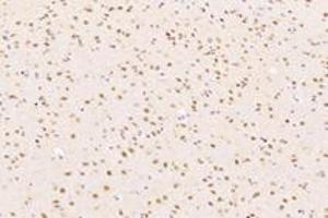 Immunohistochemistry analysis of paraffin-embedded mouse substantia nigra using RanBP16 (ABIN7073901) at dilution of 1: 2000