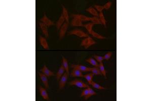 Immunofluorescence analysis of NIH/3T3 cells using TYK2 Rabbit pAb (ABIN3022987, ABIN3022988, ABIN3022989 and ABIN6219333) at dilution of 1:150 (40x lens).