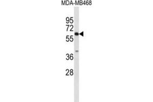 Western Blotting (WB) image for anti-Carboxylesterase 5A (CES5A) antibody (ABIN3004057)