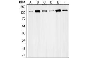 Western blot analysis of RAD50 expression in HeLa (A), K562 (B), Jurkat (C), MCF7 (D), Ramos (E), SW480 (F) whole cell lysates. (RAD50 anticorps  (Center))