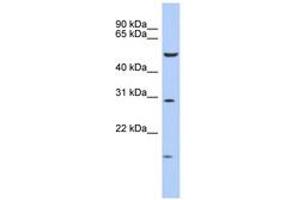 Image no. 1 for anti-Homeobox C5 (HOXC5) (AA 143-192) antibody (ABIN6742202) (Homeobox C5 anticorps  (AA 143-192))