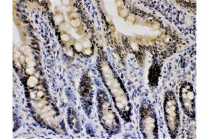 IHC analysis of CRY1 using anti-CRY1 antibody (ABIN3042761). (CRY1 anticorps  (N-Term))