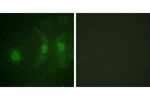Immunofluorescence analysis of HeLa cells, using IRF-3 (Phospho-Ser385) antibody.