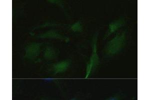 Immunofluorescence analysis of U2OS cells using TRPV1 Polyclonal Antibody at dilution of 1:100. (TRPV1 anticorps)