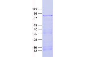 Validation with Western Blot