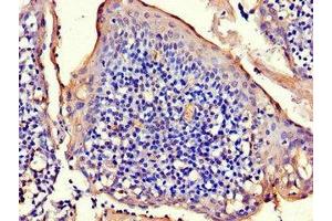 Immunohistochemistry of paraffin-embedded human tonsil tissue using ABIN7150275 at dilution of 1:100 (RAD54B anticorps  (AA 1-167))