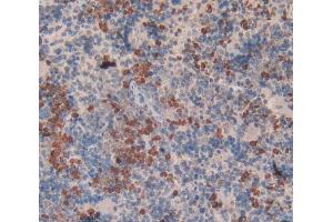 Used in DAB staining on fromalin fixed paraffin- embedded spleen tissue