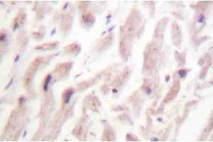 AP20222PU-N Dematin antibody staining of Paraffin-Embedded Human heart tissue by Immunohistochemistry. (Dematin anticorps)