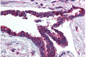 Human Lung, Respiratory Epithelium (formalin-fixed, paraffin-embedded) stained with HIF3A antibody ABIN214599 at 5 ug/ml followed by biotinylated goat anti-rabbit IgG secondary antibody ABIN481713, alkaline phosphatase-streptavidin and chromogen.