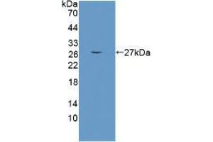 Western blot analysis of the recombinant protein. (CRAT anticorps  (AA 55-256))