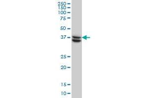 SUGT1 monoclonal antibody (M03), clone 6G5 Western Blot analysis of SUGT1 expression in HeLa . (SUGT1 anticorps  (AA 151-260))