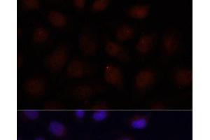 anti-Acyl-CoA Dehydrogenase, Short/branched Chain (ACADSB) antibody