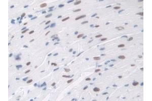 Detection of TALDO1 in Mouse Heart Tissue using Polyclonal Antibody to Transaldolase (TALDO1)