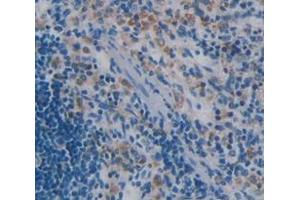 IHC-P analysis of Rat Tissue, with DAB staining. (IL-15 anticorps  (AA 49-162))