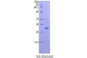 SDS-PAGE (SDS) image for Chromobox Homolog 3 (CBX3) (AA 1-183) protein (His tag) (ABIN1821703) (CBX3 Protein (AA 1-183) (His tag))