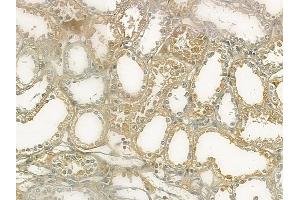 ABIN6265206 and ABIN6273074 at 1/100 staining human normal kidney tissue by IHC-P. (SNAPIN anticorps  (N-Term))