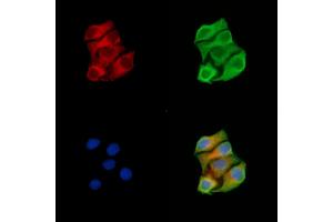 ABIN7094876 and ABIN7098928 staining Hela cells by IF/ICC. (MUT anticorps  (N-Term))