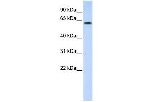 TRIM55 antibody used at 1 ug/ml to detect target protein. (TRIM55 anticorps  (N-Term))