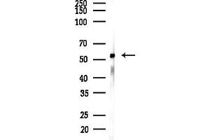 Western blot analysis of lysates from COLO205 cells(heat-shock,45 min treatment), using KPN Antibody at 1/1000 dilution.