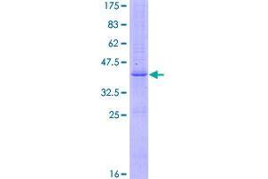 Image no. 1 for Fibroblast Growth Factor 5 (FGF5) (AA 1-123) protein (GST tag) (ABIN1354018)