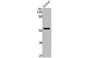 Western Blot analysis of Jurkat cells using PFK-2 liv Polyclonal Antibody (PFKFB1 anticorps  (C-Term))