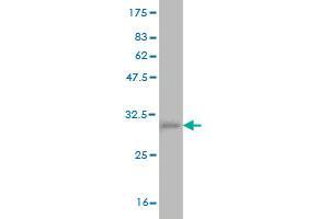 Western Blot detection against Immunogen (37.