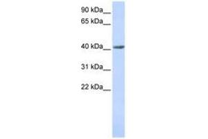 Image no. 1 for anti-SET and MYND Domain Containing 3 (SMYD3) (AA 36-85) antibody (ABIN6741089) (SMYD3 anticorps  (AA 36-85))