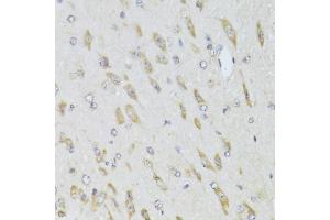 Immunohistochemistry of paraffin-embedded mouse brain using RPL13 Antibody (ABIN2559760) at dilution of 1:100 (40x lens). (RPL13 anticorps)