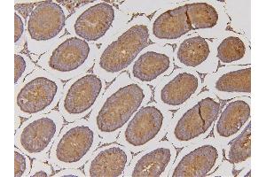 IHC analysis of EHD1 using anti-EHD1 antibody (ABIN6719599). (EHD1 anticorps  (AA 324-516))