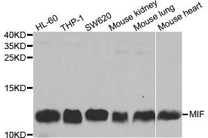 Western blot analysis of extracts of various cell lines, using MIF antibody. (MIF anticorps)