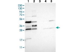 Western blot analysis of Lane 1: RT-4, Lane 2: U-251 MG, Lane 3: Human Plasma, Lane 4: Liver, Lane 5: Tonsil with RRP15 polyclonal antibody  at 1:250-1:500 dilution. (RRP15 anticorps)