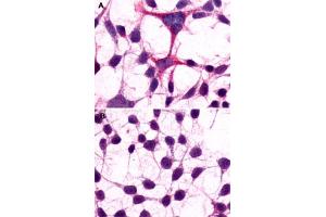 Immunocytochemistry (ICC) staining of HEK293 human embryonic kidney cells transfected (A) or untransfected (B) with GRM3. (Metabotropic Glutamate Receptor 3 anticorps  (Extracellular Domain))