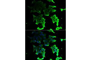 Immunofluorescence analysis of HeLa cell using TANK antibody. (TANK anticorps)