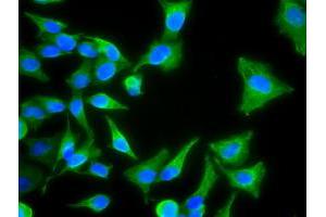 Image no. 7 for anti-Keratin 8 (KRT8) (AA 91-381) antibody (ABIN1491713)