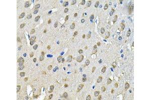 Immunohistochemistry of paraffin-embedded Rat brain using PRKAB2 Polyclonal Antibody at dilution of 1:100 (40x lens). (PRKAB2 anticorps)