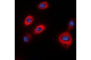 Immunofluorescent analysis of TPH1 staining in HepG2 cells.