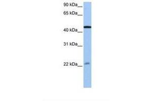 Image no. 1 for anti-Ewing Sarcoma Breakpoint Region 1 (EWSR1) (AA 173-222) antibody (ABIN6737947) (EWSR1 anticorps  (AA 173-222))