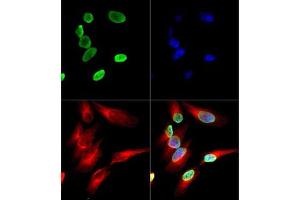 Immunofluorescence of Histone H4 K12-Ac (RABBIT) Antibody: Histone H4 K12-Ac antibody was tested in HeLa cells with DyLight 488 (green).