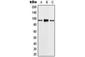 Western blot analysis of PLA2G4A expression in HeLa (A), THP1 (B), NIH3T3 (C) whole cell lysates. (PLA2G4A anticorps  (Center))