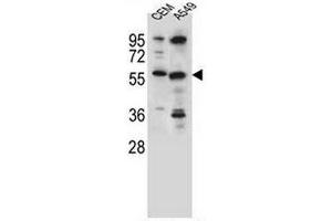 CSAD Antibody (Center) western blot analysis in CEM,A549 cell line lysates (35µg/lane). (CSAD anticorps  (Middle Region))