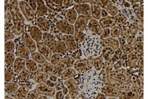 ABIN6277109 at 1/100 staining Rat kidney tissue by IHC-P.