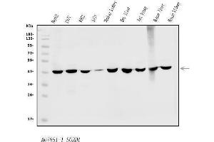 Western blot analysis of Sorbitol Dehydrogenase/ SORD using anti-Sorbitol Dehydrogenase/ SORD antibody (ABIN7602486).