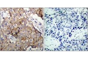 Immunohistochemistry (IHC) image for anti-Epidermal Growth Factor Receptor (EGFR) (AA 1061-1110) antibody (ABIN2888974) (EGFR anticorps  (AA 1061-1110))