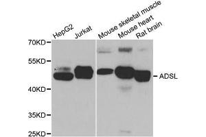 Western blot analysis of extracts of various cell lines, using ADSL antibody. (Adenylosuccinate Lyase anticorps  (AA 1-310))