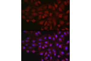 Immunofluorescence analysis of  cells using BDKRB1 Rabbit pAb (ABIN7265910) at dilution of 1:250 (40x lens).