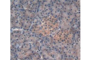 IHC-P analysis of pancreas tissue, with DAB staining. (EPRS anticorps  (AA 749-956))