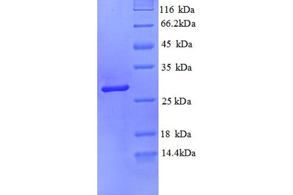 PRSS3 Protein (AA 81-303, partial) (His tag)