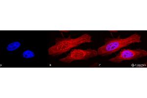 Immunocytochemistry/Immunofluorescence analysis using Rabbit Anti-Alpha B Crystallin Polyclonal Antibody . (CRYAB anticorps  (Atto 390))